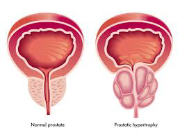 homeopathy-image